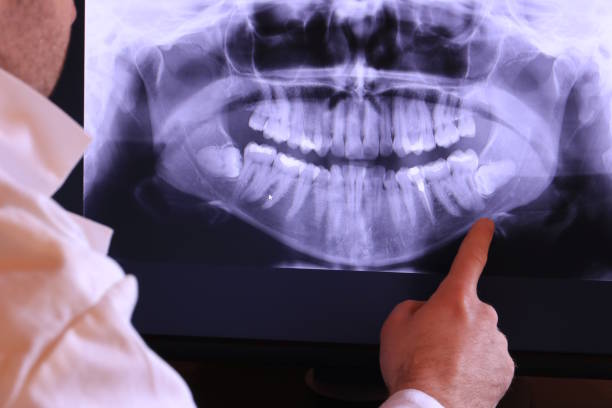 Best Urgent Care for Lost Fillings or Crowns in Richland, WA